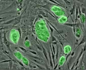 A microscopic image of mouse embryonic stem cells shown in green due to the presence of a green fluorescent marker.