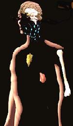 Drawing of an outline of the organ's of a person's immune system. Shown are the lymph nodes, thymus, and spleen.