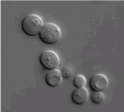 Yeast cells as seen through a microscope.