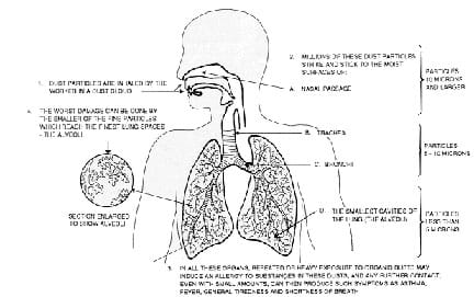 A cut-away human body diagram with a description of the intake of dust particles; how they stick to nasal passage, trachea, bronchi, lungs and alveoli surfaces; symptoms of repeated or heavy exposure to dusts; and worst damage when smallest particles reach alveoli.