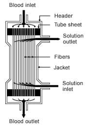 A drawing of kidney dialysis machine's hollow fiber dialyzer showing the blood inlet and outlet, solution inlet and outlet, and fibers.