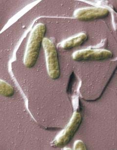 A microscopic photograph shows long, oval ameba-like bacterial organisms on a brown surface.