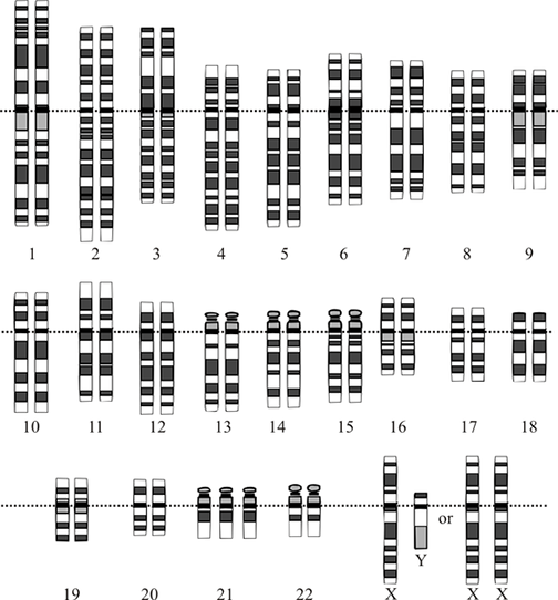 An illustration that shows 47 chromosomes organized into numbered homologous pairs, with the exception being location 21 that has three copies of that chromosome (one extra).
