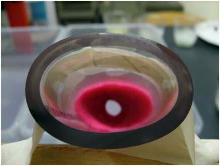 Photo looking into the end of a piece of plastic tubing shows it almost completely blocked by red material, except for a small opening. Photo looking into the end of a piece of plastic tubing shows it almost completely blocked by red material, except for a small opening.