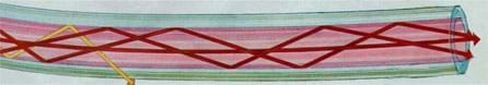A drawing shows a long transparent tube. Inside, three red arrows continuously hit and reflect off the inside walls, as they progress down the tube. A yellow arrow does the same until at one point it departs the tube.