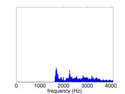 The spectrum with the low frequencies removed and the high frequencies unaffected. The left third of the graph is blank (all data removed).