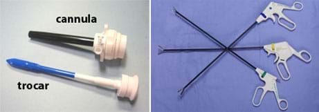 Two photos: (left) Two instruments. Both have long, slender rods attached to wide ends. The trocar has one pointed end and narrower rod. (right) Three instruments. All have scissors-like handles attached to long rods with small grasping or cutting tools at the ends.