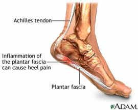 Lifelike drawing shows what's under the skin of a human foot. You can see the ankle and foot bones with stringy pieces running behind the ankle and heel (Achilles tendon) and under the heel arch (plantar fascia) to the ball of the foot. A note says that inflammation of the plantar fascia can cause heel pain.