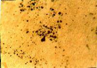 A microscopic photograph shows dark and uniformly granular objects on a light brown background. 