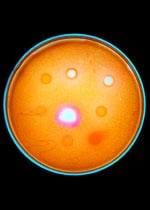 Microscopic photo shows an orange circle with white dots. 
