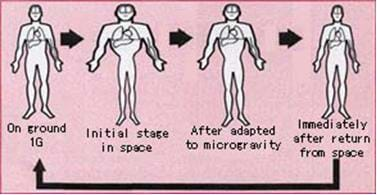 From left to right, four figures represent the stages of fluid shift during space flight. On the left, a person on the ground shows fluids at normal. Next, when they first get into space, they have a swollen torso and head, and after being in space for awhile, they experience some fluid loss but torso and head are still slightly swollen. Last, once they get back to Earth, they have a normal-sized head and torso.