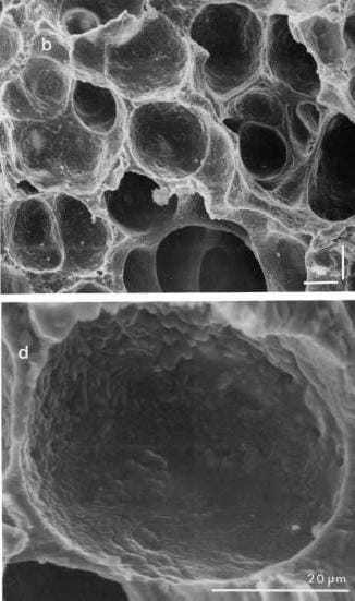 SEM image of alveoli with a magnified image of a single air sac below it.