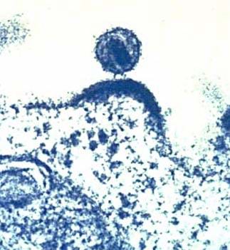 A microscopic image shows a human cell (blue and speckled) with a small circle coming off of it - a virus.