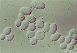 A microscopic photograph shows a clustering of about 25 gray oval shapes.