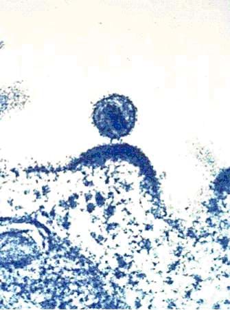 photomicrograph of HIV budding from host cell