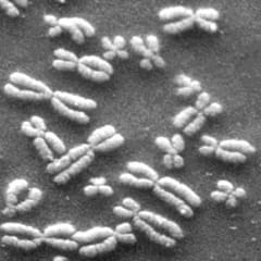 A black and white microscopic photograph shows what looks llike an assortment of whitish plump x-shaped objects on a black background.