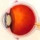 preview of 'Biomedical Devices for the Eyes' Lesson