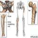 preview of 'Bone Fractures and Engineering' Lesson