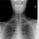 preview of 'You Be the Radiologist! Strain Graphs That Reveal Tumors' Activity