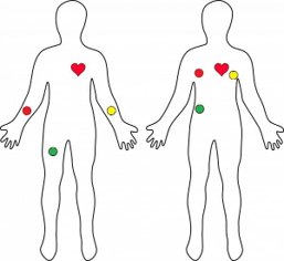 A figure showing outlines of human bodies with marked locations for typical sensor placements.