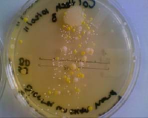 Photo of a Petri dish containing multi-colored bacterial colonies.