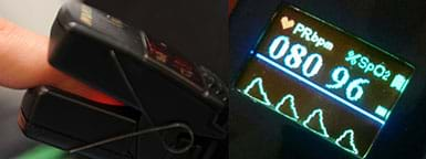 Digital pulse oximeter and its screen displaying SpO2 level, heart beat rate, and photoplethysmogram.