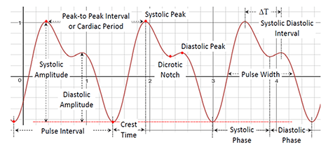 Main parts of a Photoplethysmografic pulse.