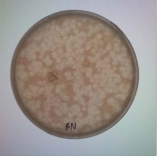 An image of a petri dish shows a tan “lawn” of agar with many spots that indicate where bacteriophages have killed the bacteria that grew on the lawn.