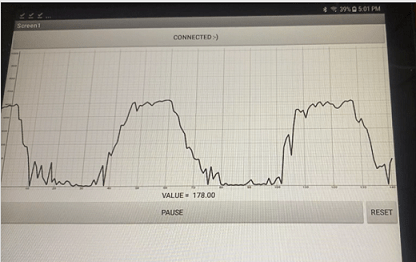 An Android tablet running an app that displays uterine contractions graphically. Three contractions of pressure vs time are displayed.