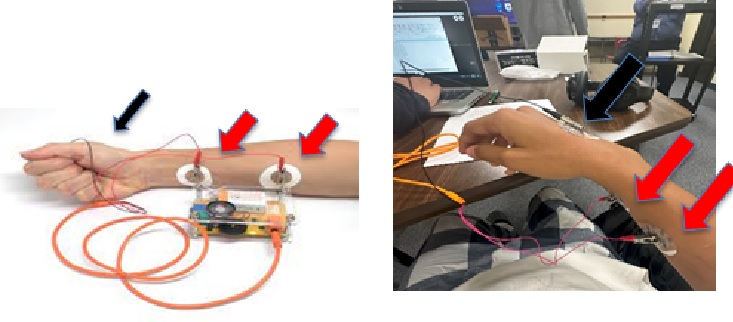 An image of an arm with electromyogram (EMG) skin electrodes placed for collecting muscle data.