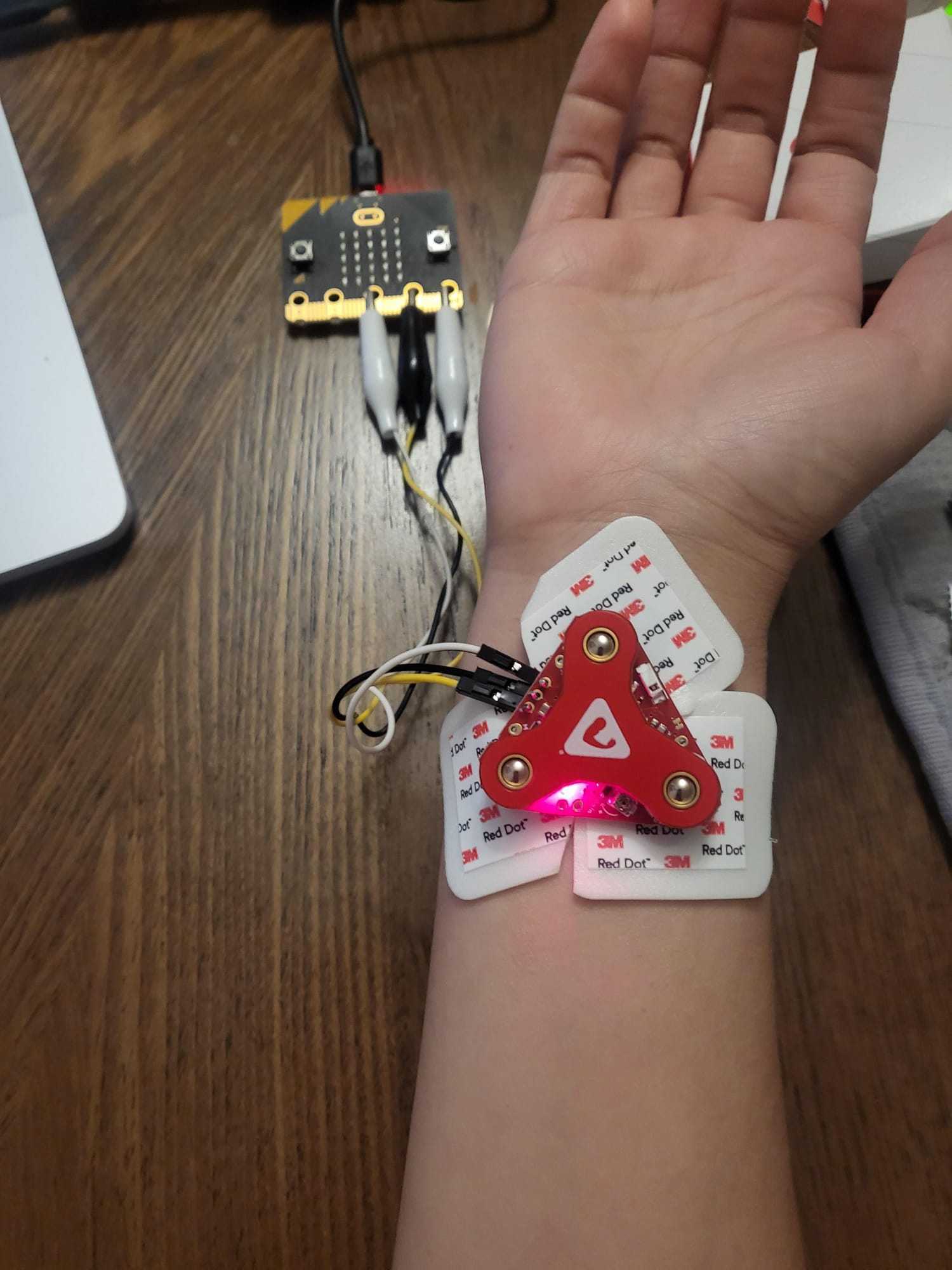 A photo showing a muscle sensor with electrodes attached right under the wrist and the clip alligators attached from the muscle sensor to the micro:bit