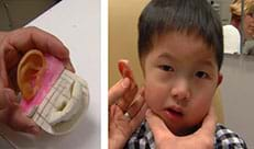 (top) A hand on the left holds an ear that has been 3D printed for a patient, on the right the ear is being held next to the patients head as if about to put it on. 