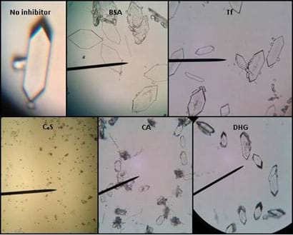 A composite image of six microscopic photographs shows six types of calcium oxalate crystals grown with and without inhibitors (no inhibitor, BSA, Tf, C4S, CA, DHG). Each image is under a 40x optical lens except C4S, which is under a 20x objective lens.