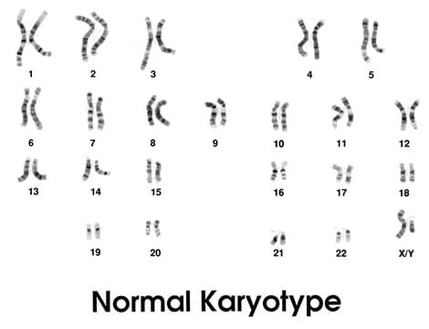 An illustration shows 46 chromosomes numbered and organized into 23 homologous pairs. An illustration shows 46 chromosomes numbered and organized into 23 homologous pairs.