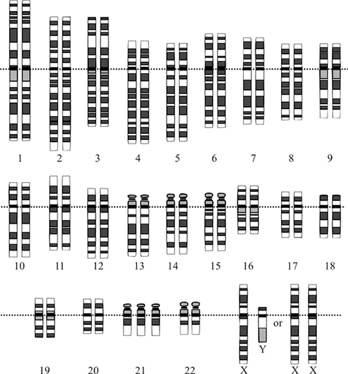An illustration that shows 47 chromosomes organized into numbered homologous pairs, with the exception being location 21 that has three copies of that chromosome (one extra). An illustration that shows 47 chromosomes organized into numbered homologous pairs, with the exception being location 21 that has three copies of that chromosome (one extra).