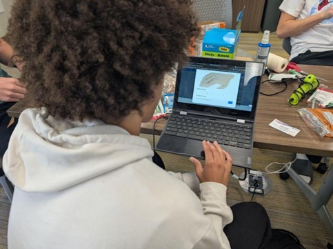 A split-view photo showing the software and hardware integration of the smart prosthetic.