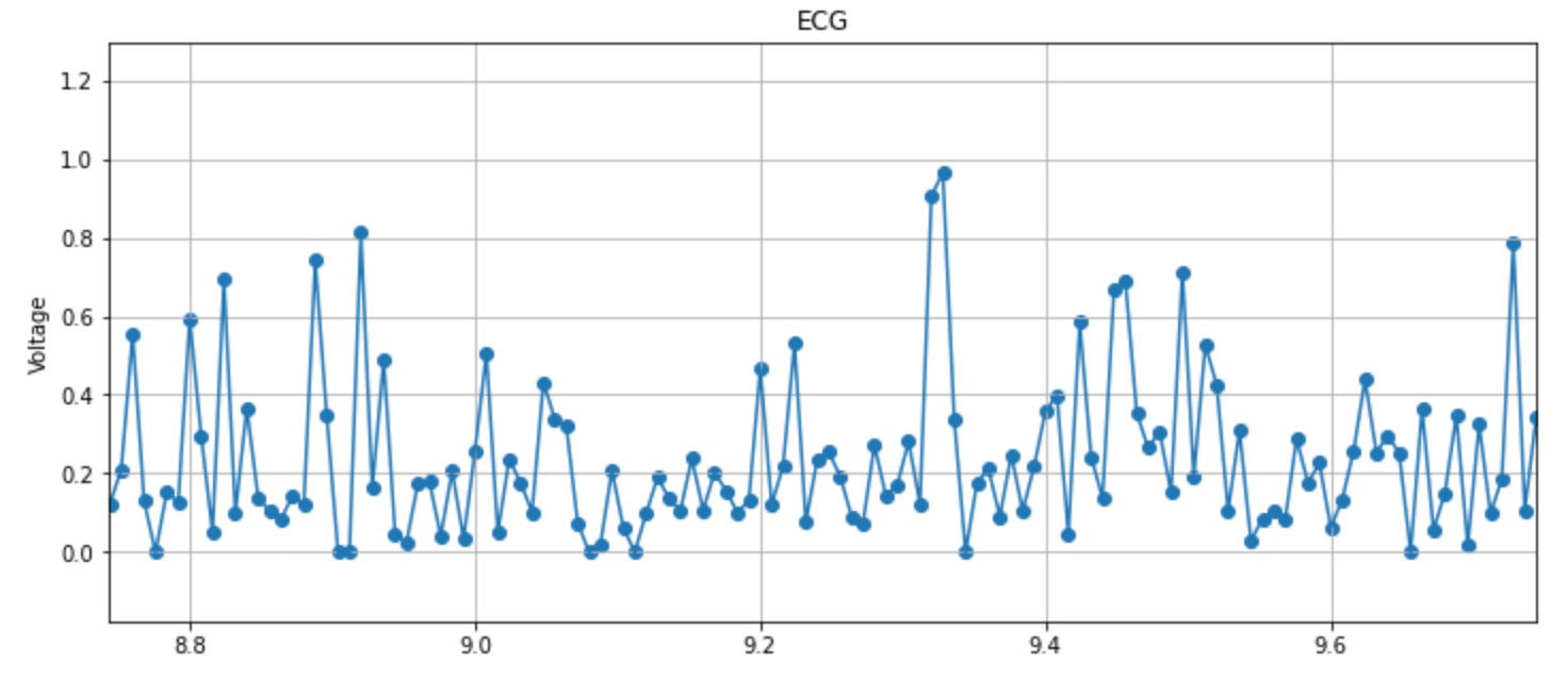 A graphical display of an ECG reading. The electrical signal moves in a pattern from the beginning to the end. 