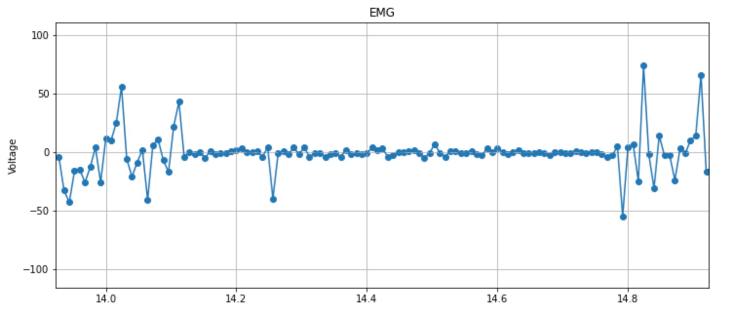 A graphical display of an EMG reading. The electrical signal is flat in the middle, but shows stimulation on the ends. 