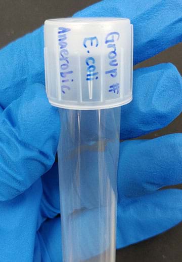 A photo shows a culture tube with the label “Group # E. Coli Anaerobic” on the cap.