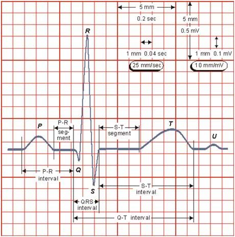 EKG