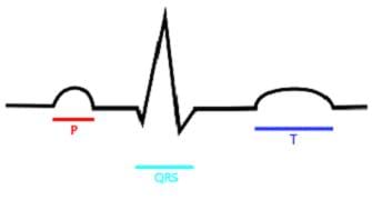 A line drawing shows the heartbeat with portions marked as P, QRS and T.