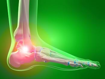 A medical drawing shows a human foot and angle bone.