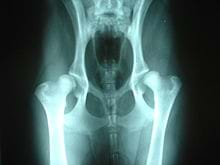 An x-ray showing someone with hip dysplasia.
