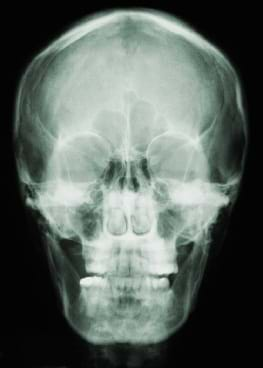 X-ray of a human skull.